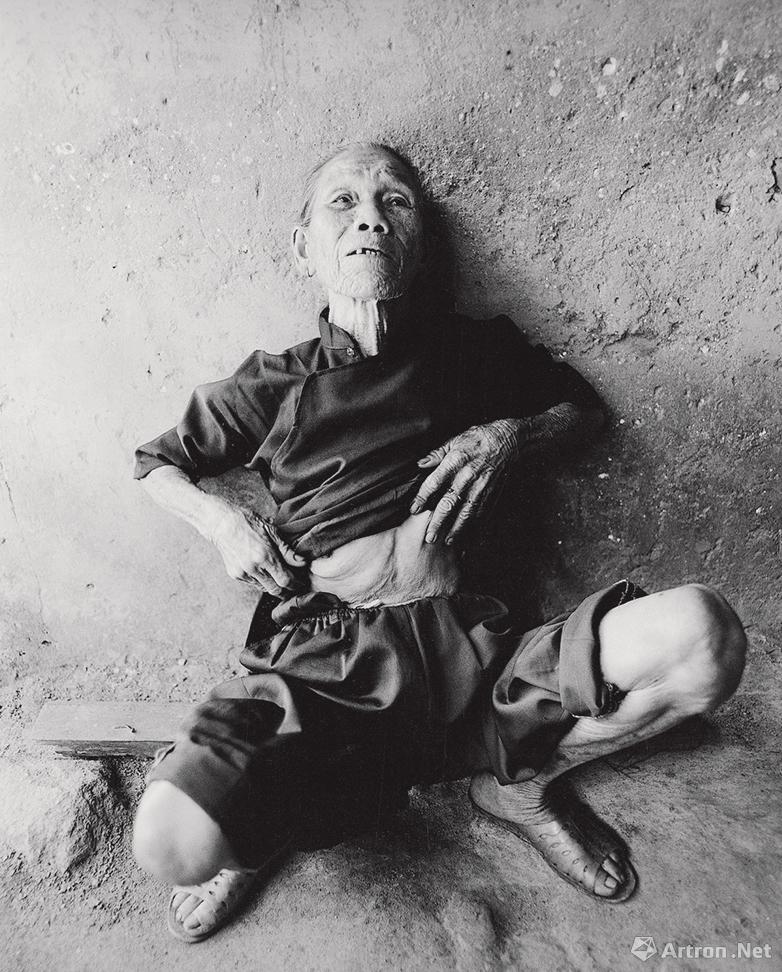 黄一鸣作品：蔡爱花因被日本兵用脚蹬踢腹部致伤残，常年腰痛和腹腔疼痛。